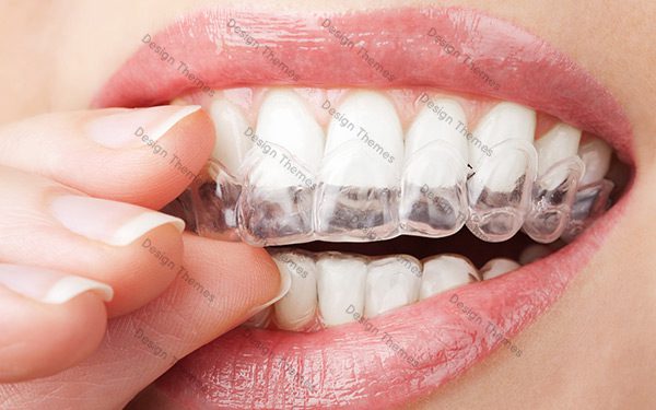 A woman is putting teeth whitening strips on her mouth.