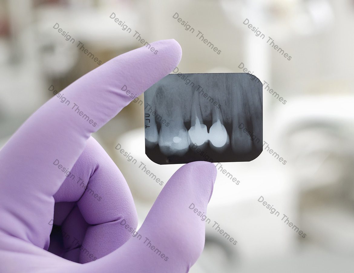 A person holding an x-ray of teeth