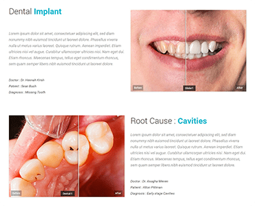 A page with teeth and text about dental implants.